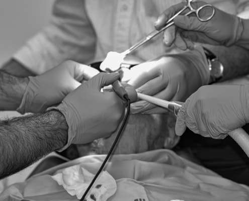 Hartmetall Das Material Für Chirurgische Instrumente